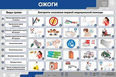 Интерактивный электрифицированный стенд "Ожоги"