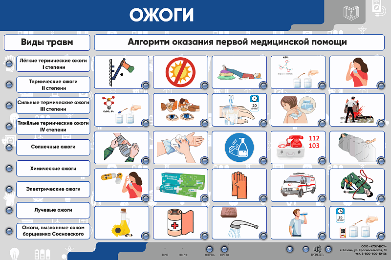 Интерактивный электрифицированный стенд "Ожоги"